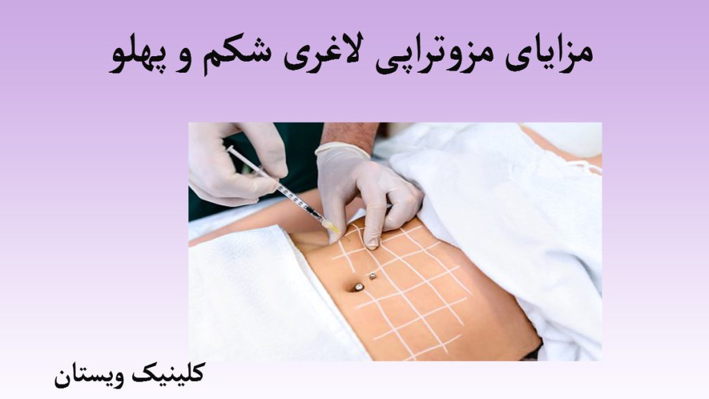 مزایای مزوتراپی لاغری یک تصویر کوچک بر روی یک قاب با زمینه بنفش و سفید و یک پزشک که در حال تزریق به شکم بیمار است.