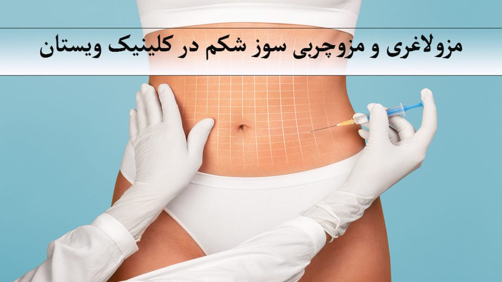 شکم یک شخص که بصورت شطرنجی برای تزریق مزولاغغری شکم خط کشی شده است