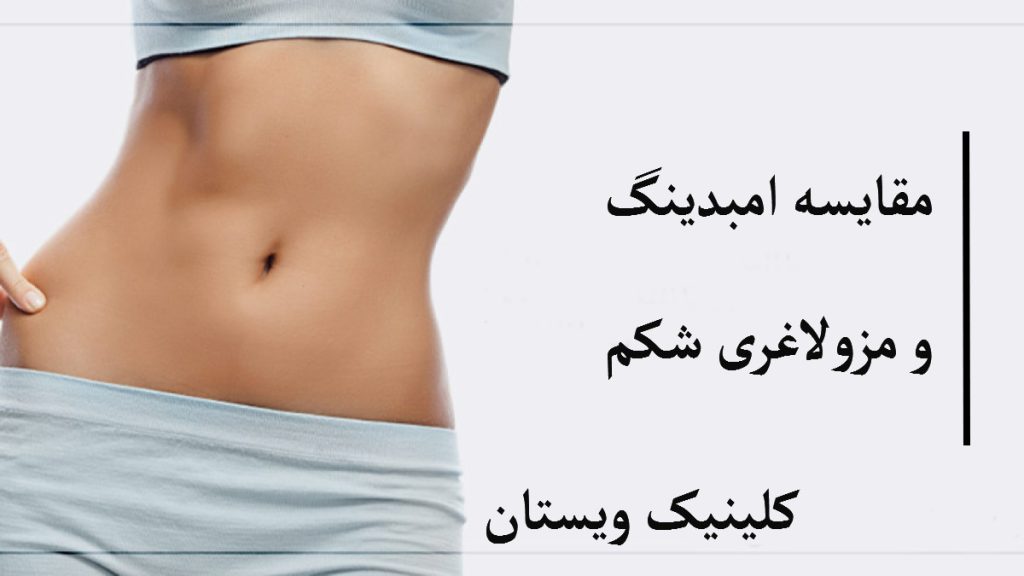 مزوتراپی شکم و امبدینگ شکم شکم یک خانم که لاغر شده است