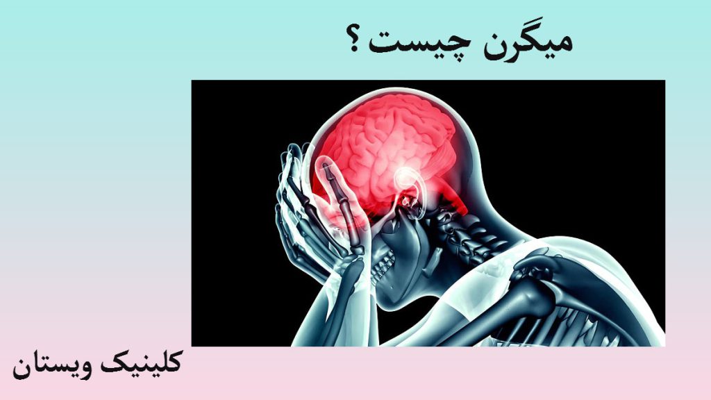میگرن تصویری دیجیتالی از یک شخص که میگرن دارد و سردرد او با رنگ قرمز نشان داده شده است