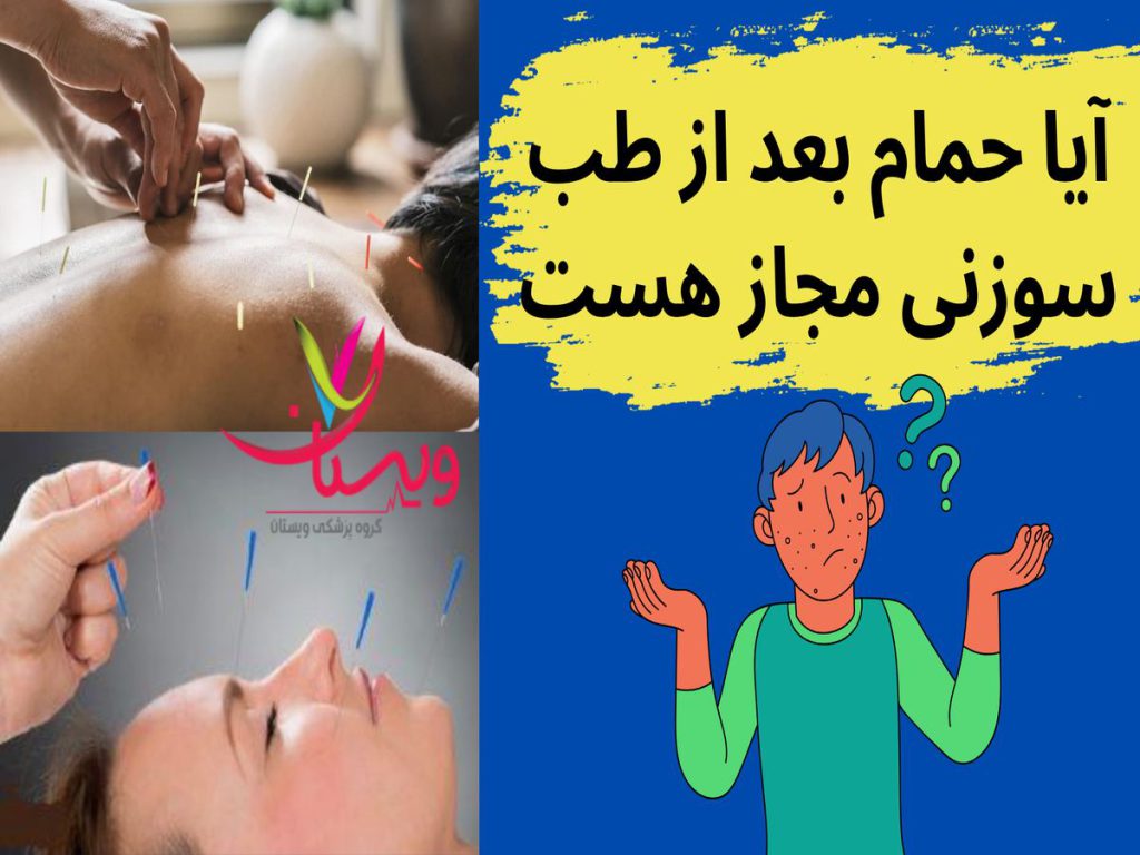 تأثیرات مثبت طب سوزنی آیا حمام بعد از طب سوزنی مجاز هست