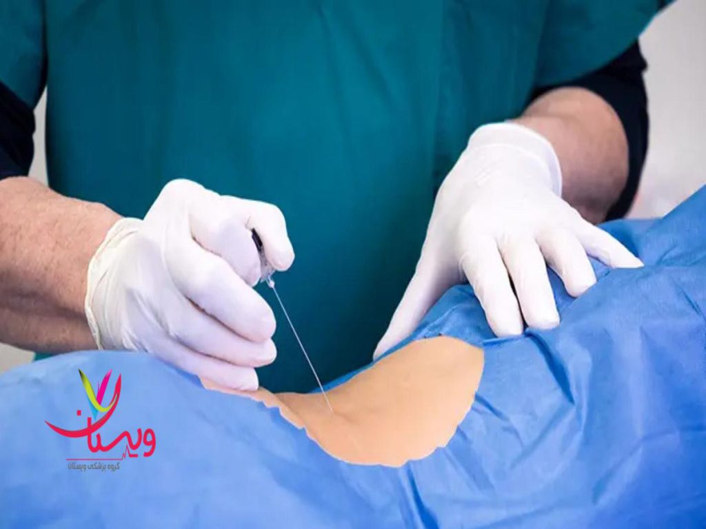 درمان کمر درد آیا پی آر پی کمر درد دارد