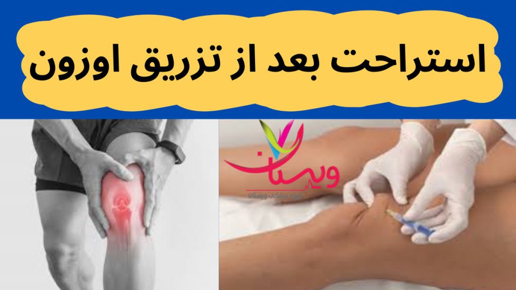 کمپرس سرد استراحت بعد از تزریق اوزون