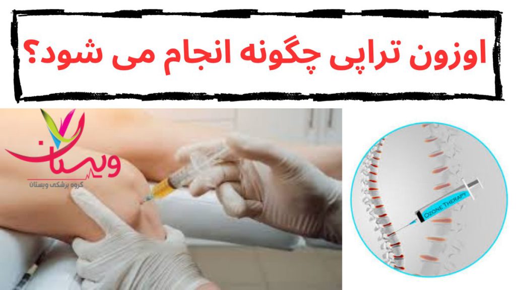 ناحیه آسیبدیده اوزون تراپی چگونه انجام می شود
