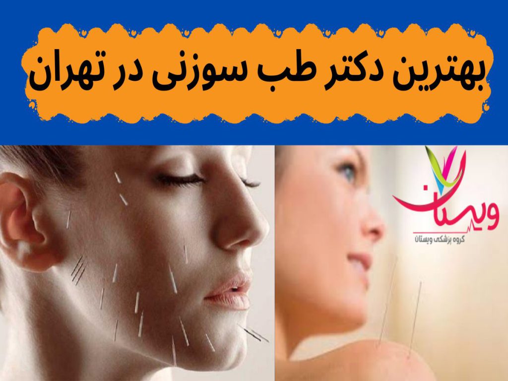 تخصص در طب سوزنی بهترین دکتر طب سوزنی در تهران