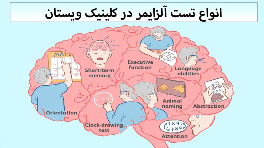 تست آلزایمر چند تصویر در یک تصویر از مغز