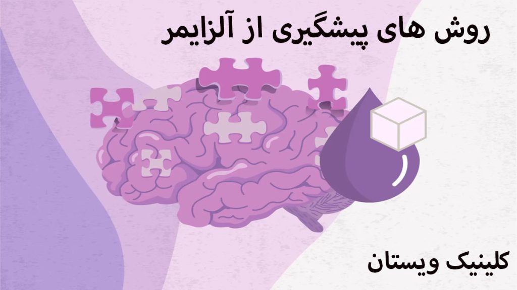 پیشگیری از آلزایمر تصویری انیمیشنی از مغز