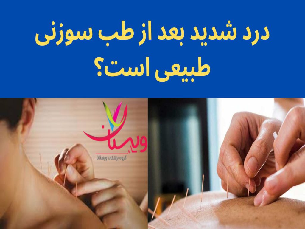 عوارض جانبی ناشی از طب سوزنی درد شدید بعد از طب سوزنی طبیعی است