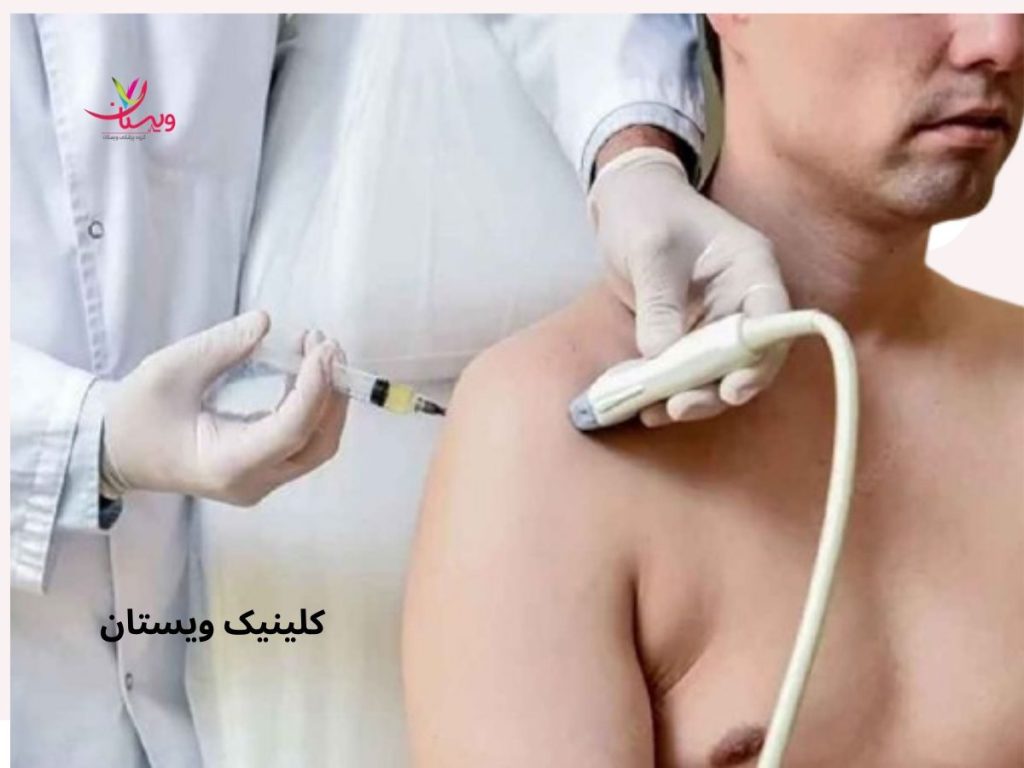 شانه یخزده شانه یخ زده و دلایل آن چیست