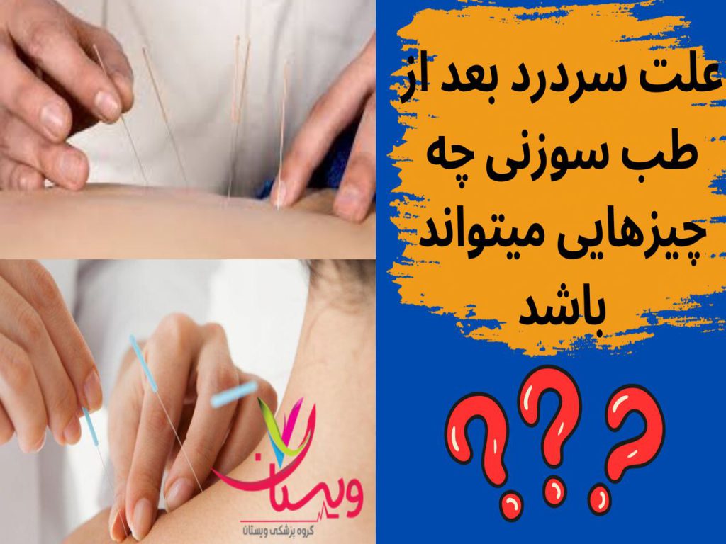 سردرد بعد از طب سوزنی علت سردرد بعد از طب سوزنی چه چیزهایی میتواند باشد