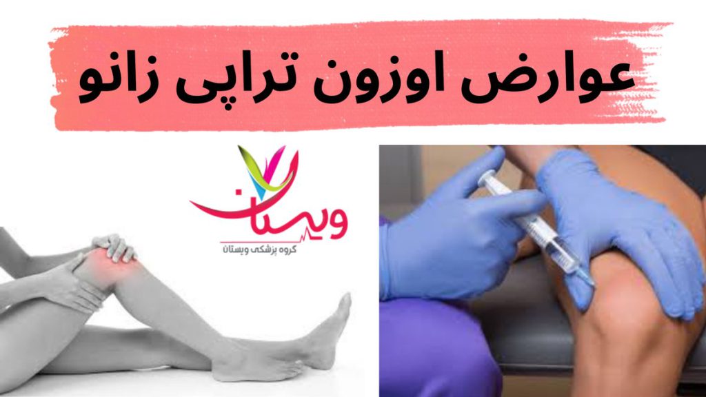 ناحیه تزریق عوارض اوزون تراپی زانو