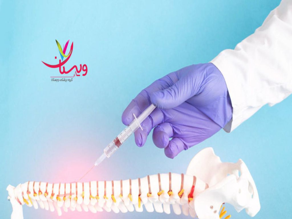 زمان ماندگاری PRP ماندگاری PRP کمر