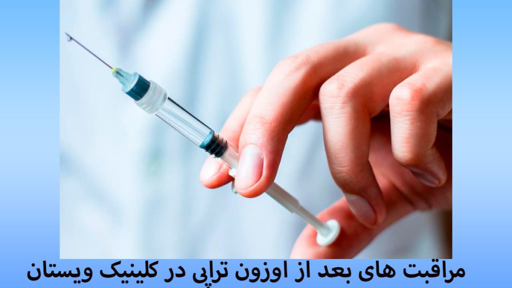 مراقبت های بعد از اوزون تراپی یک سورنگ حاوی اوزون