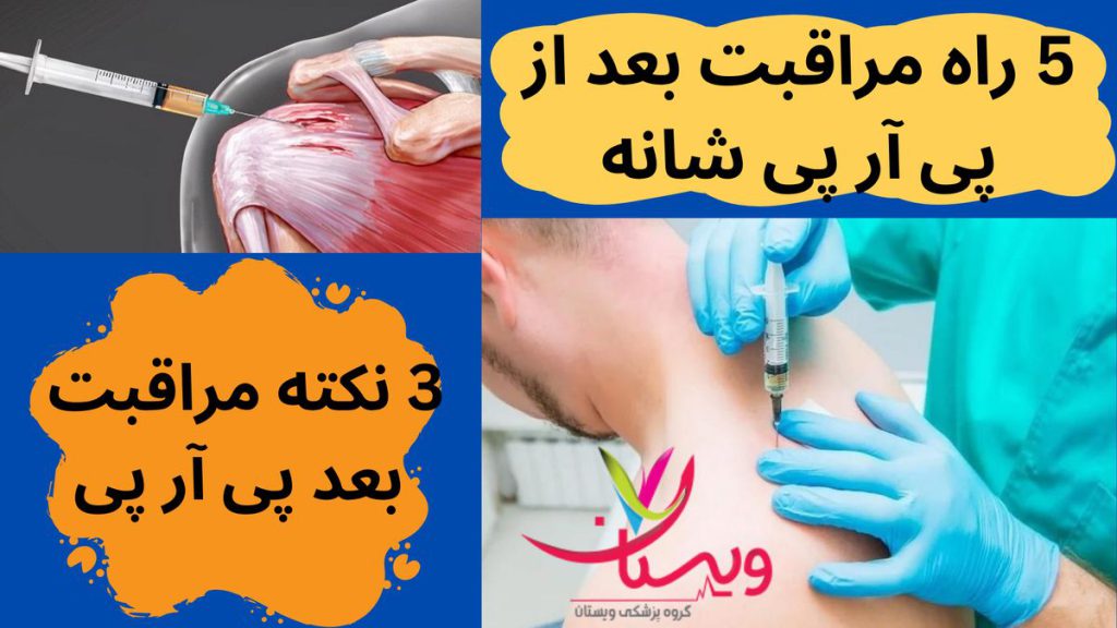 مراقبت بعد از پی آر پی شانه
