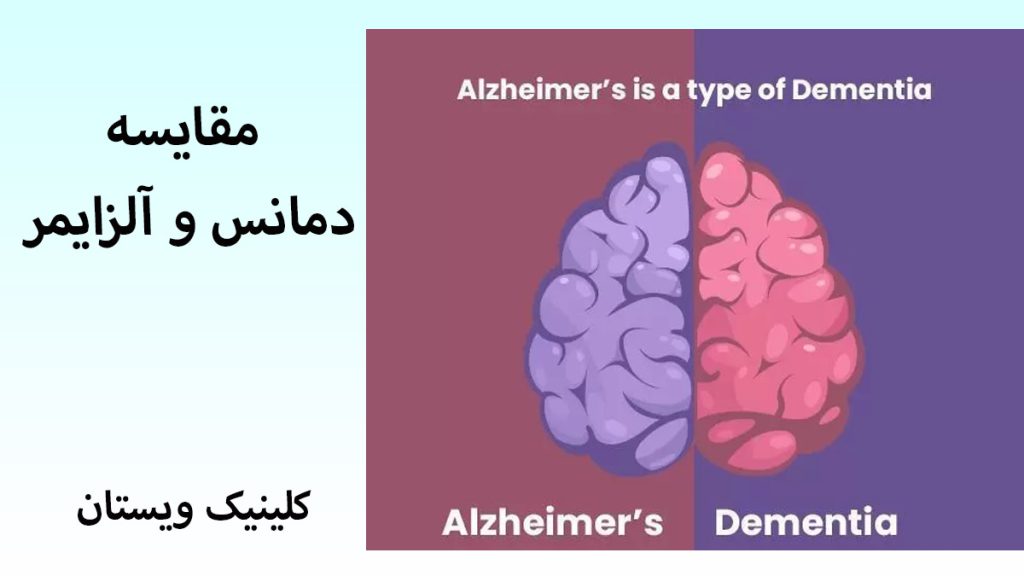 دمانس و آلزایمر یک مغز به رنگ بنفش و صورتی برای نمایش زوال عقل و دمانس