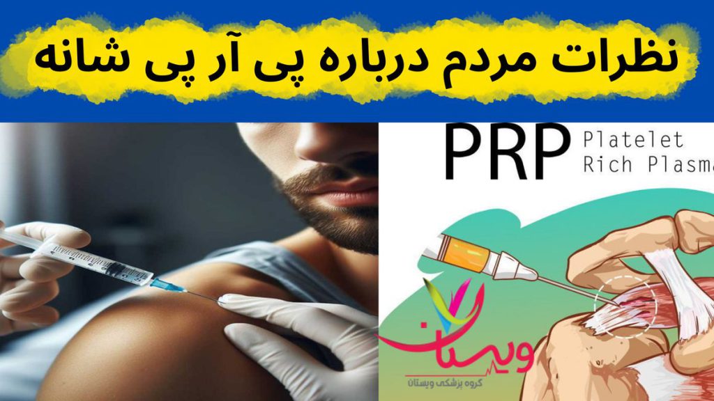 درمان درد شانه نظرات مردم درباره پی آر پی شانه
