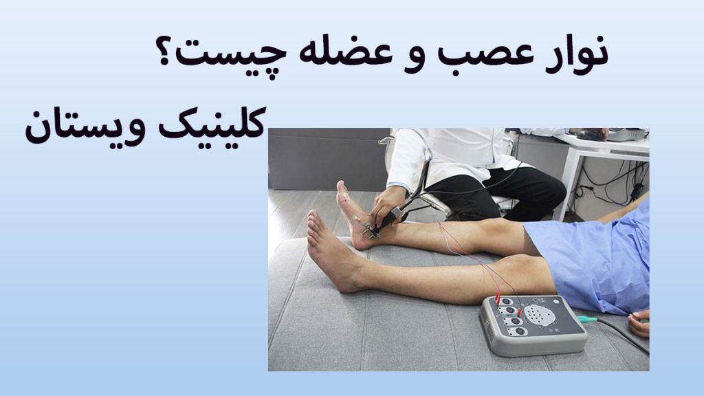 نوار عصب و عضله پزشک در حال انجام نوار عصب پا
