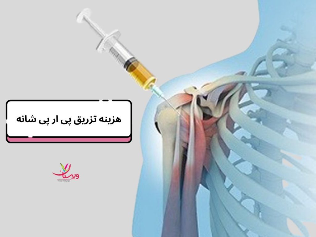 تزریق پی آر پی هزینه تزریق پی ار پی شانه