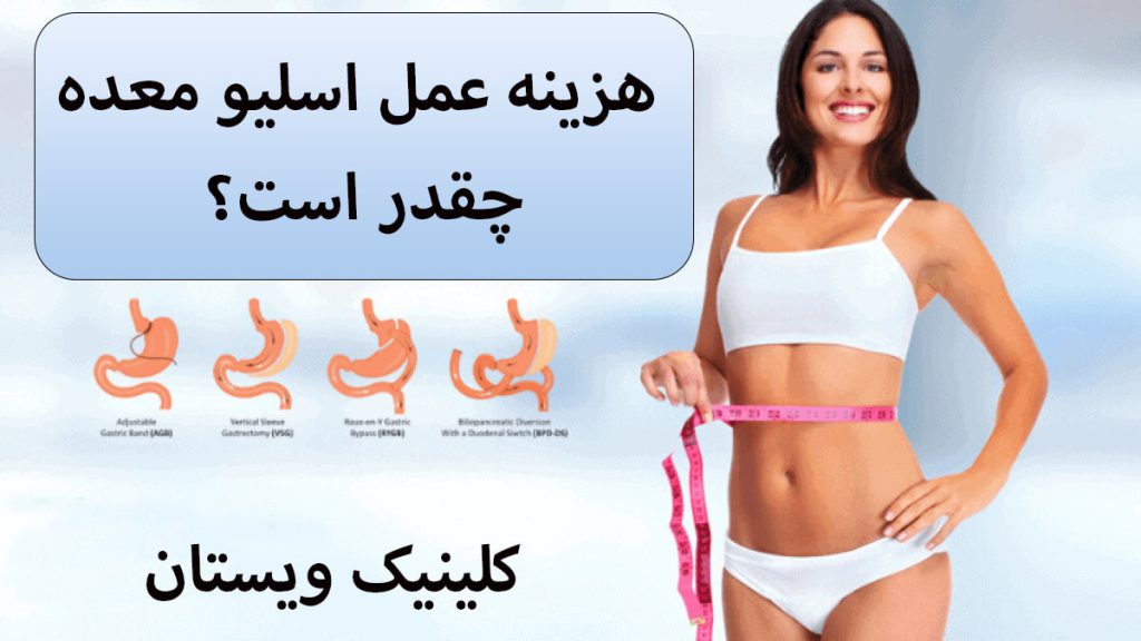 هزینه عمل اسلیو معده یک خانم در کنار تصاویری کوچک از مراحل اسلیو معده