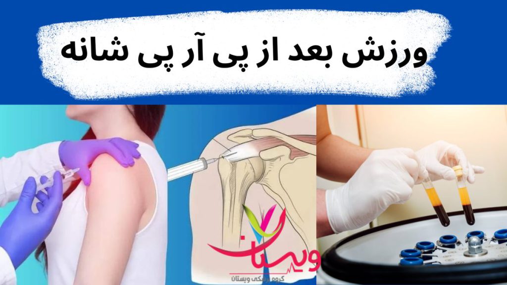 تقویت عضلات اطراف شانه ورزش بعد از پی آر پی شانه