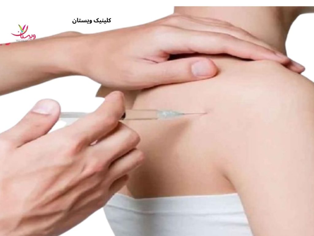 تاندونیت شانه پی آر پی شانه برای درمان چه بیماری هایی مورد استفاده قرار می گیرد