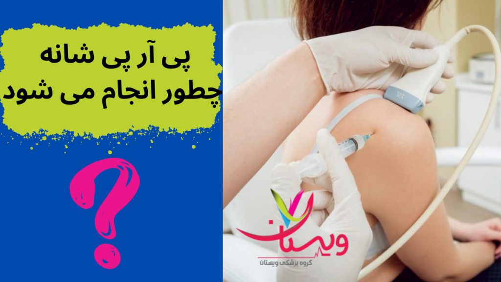 تزریق پی آر پی شانه پی آر پی شانه چطور انجام می شود