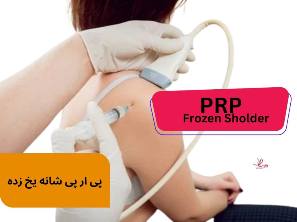 پی ار پی شانه یخ زده