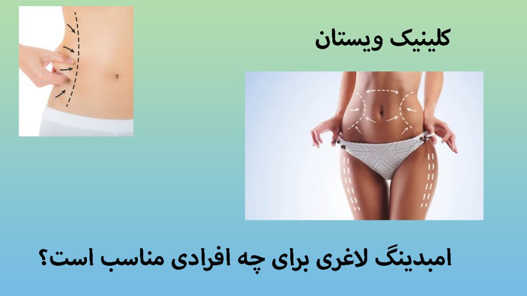 امبدینگ برای چه کسانی مناسب است دو تصویر از دو خانم که امبدینگ لاغری انجام داده اند
