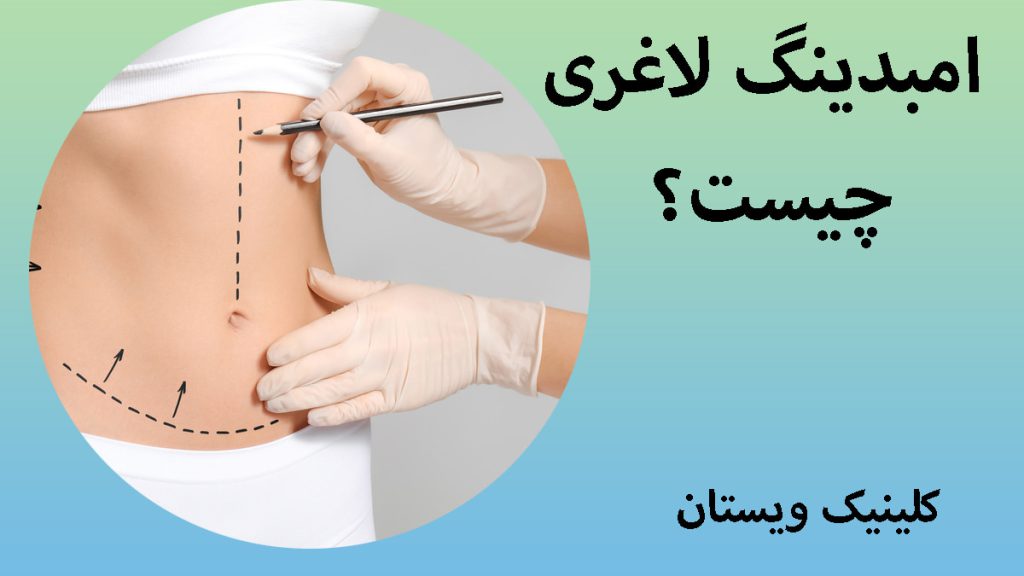 امبدینگ لاغری یک شخص در حال خط کشی شکم بیمار برای امبدینگ لاغری