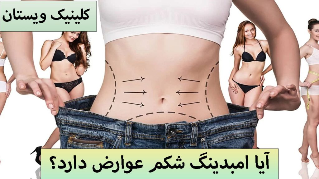 عوارض امبدینگ یک تصویر بزرگ از شکم خانم که برای امبدینگ خط کشی شده است و چند تصویر کوچک