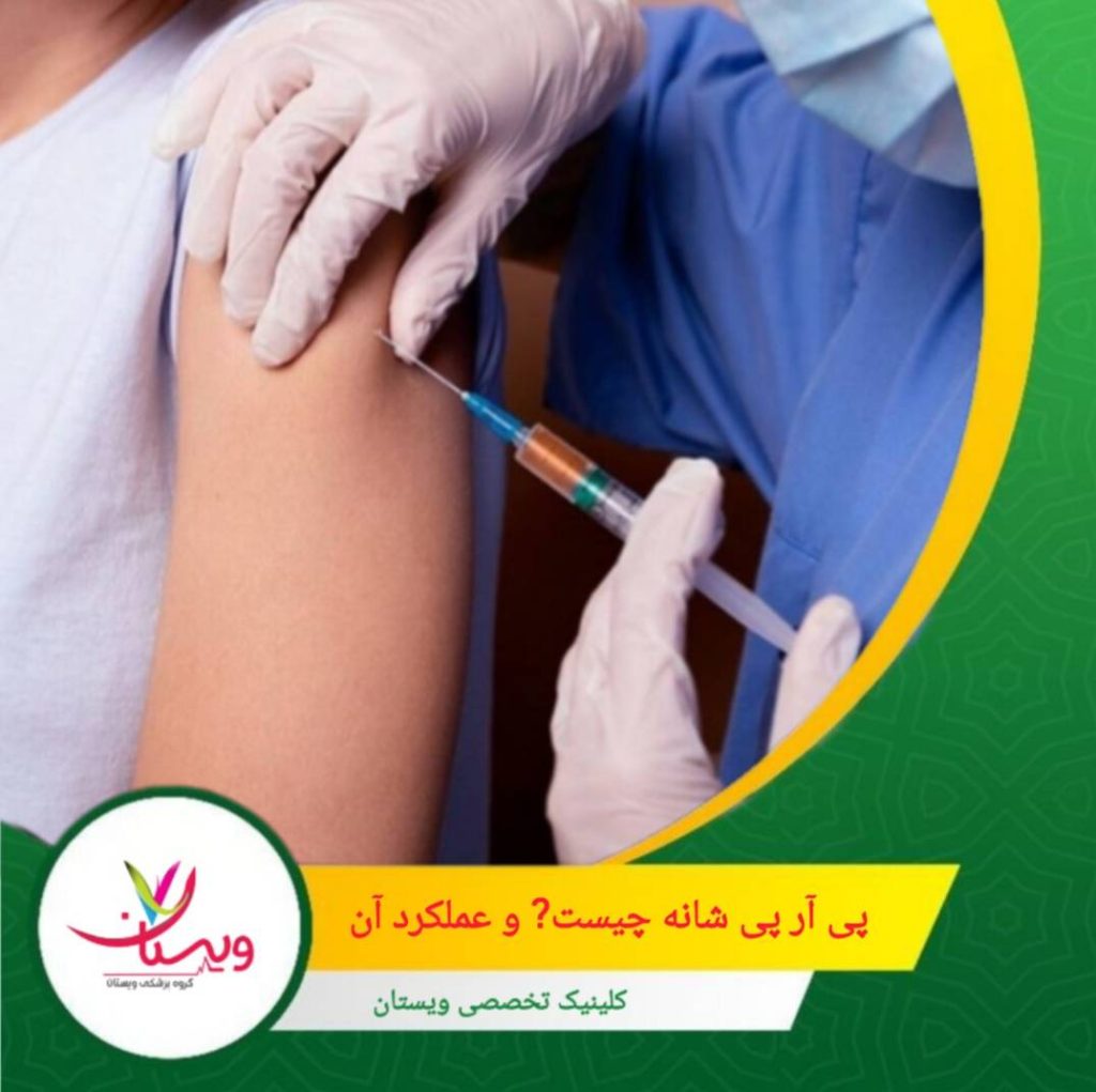 به دلیل استفاده از خون خود بیمار، واکنشهای آلرژیک یا عفونت بسیار کم است. پی آر پی شانه چیست؟ و عملکرد آن