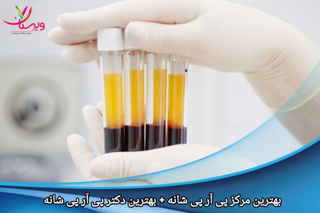 بهترین مرکز پی آر پی شانه+ بهترین دکتر پی آر پی شانه درتهران