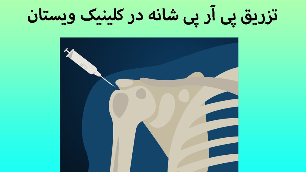 تزریق PRP شانه تزریق PRP شانه