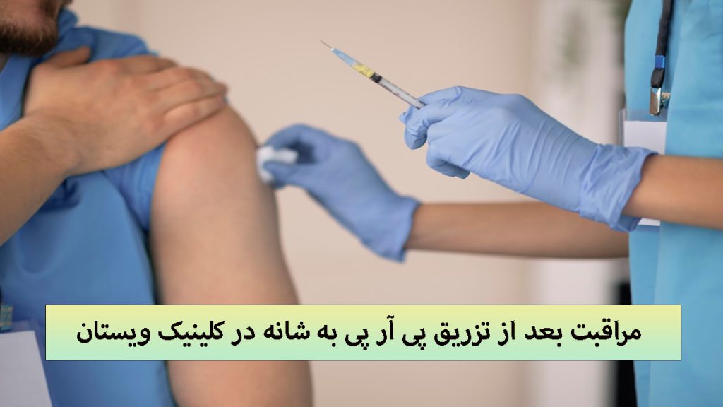 مراقبت بعد از تزریق PRP پزشک در حال تزریق پی ار پی