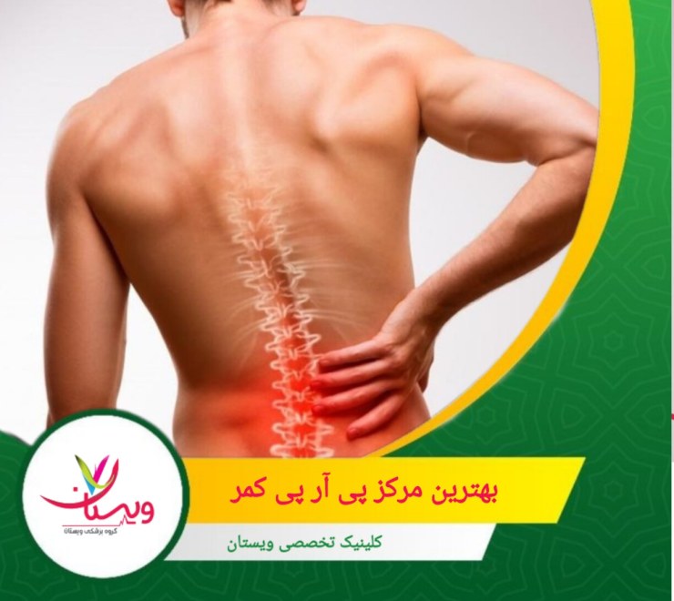 بهترین مرکز پی آر پی کمر