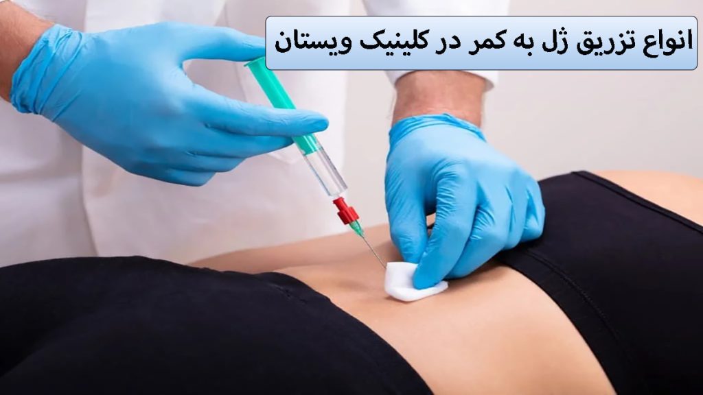هزینه تزریق ژل کمر یک پزشک در حال تزریق ژل به کمر بیمار