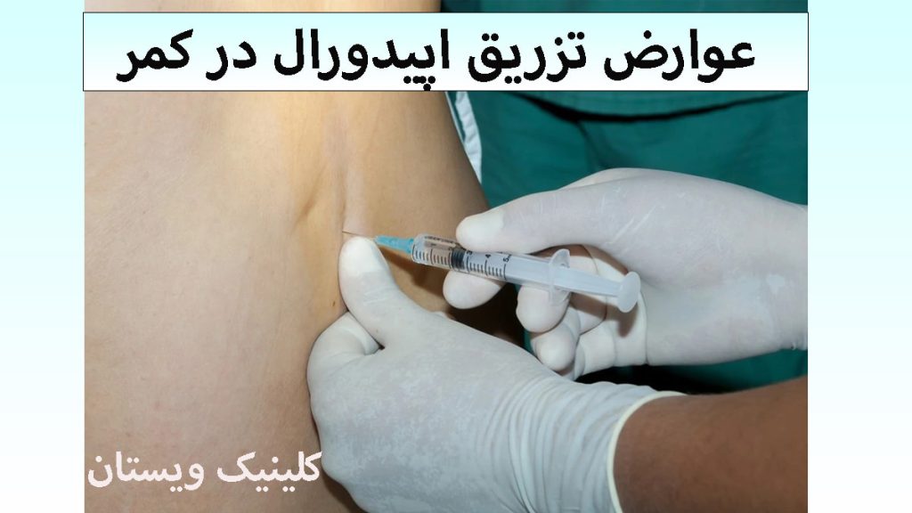 عوارض تزریق اپیدورال پزشک در حال فرو کردن سوزن برای درمان مشکل کمر بیمار