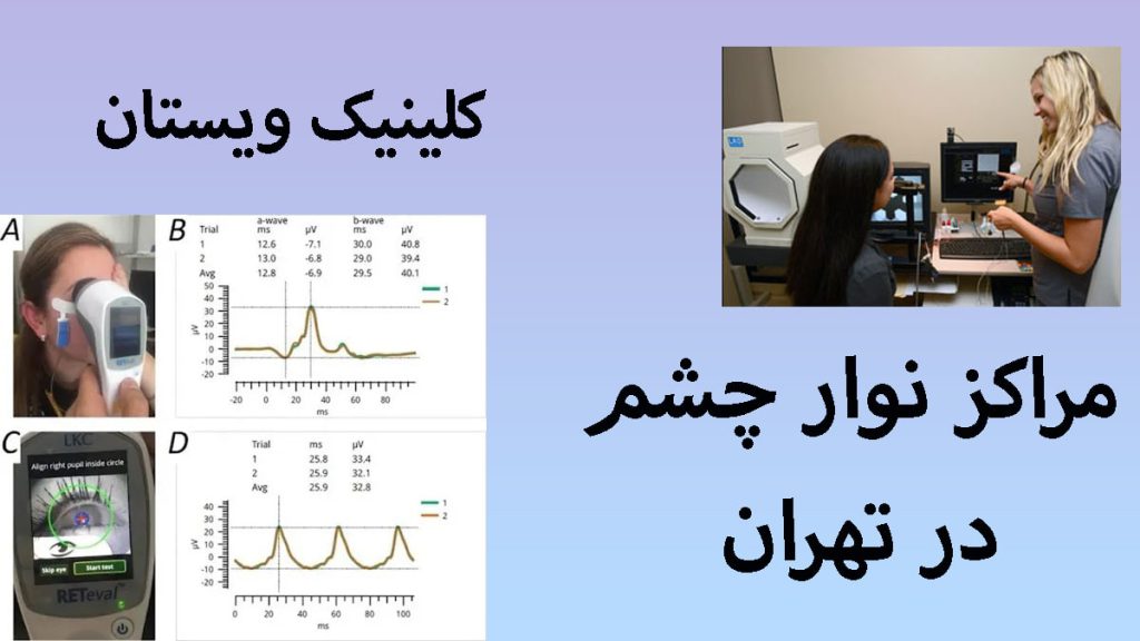 مراکز نوار چشم دو تصویر از نوار عصب
