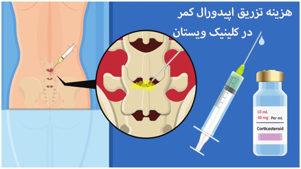 یک آمپول برای تزریق اپیدورال به کمر در کنار تزریق به کمر