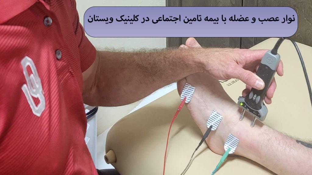 الکترودهای نوار عصب و عضله بر روی پای یک شخص