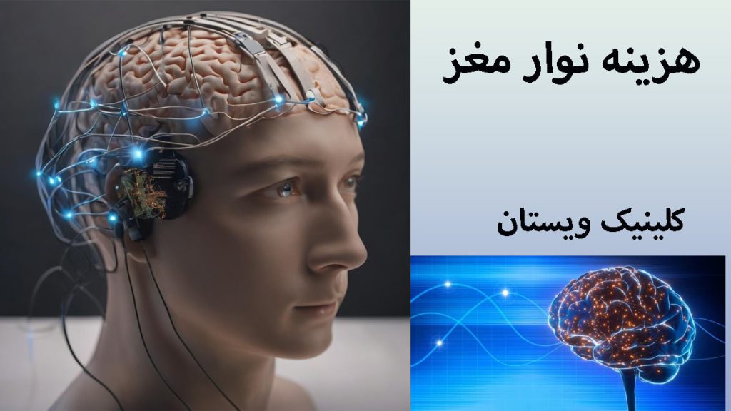هزینه نوار مغز دو تصویر از نوار مغز انسان-نوشته با عنوان هزینه نوار مغز