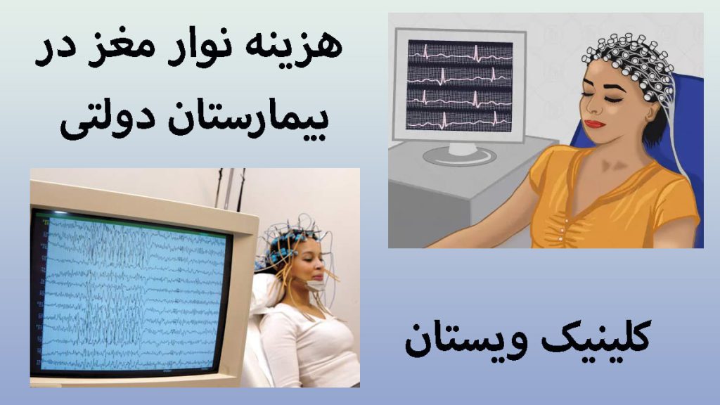 هزینه نوار مغز در بیمارستان دو تصویر از انجام نوار مغز