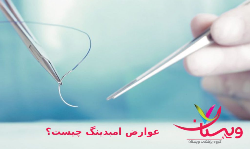 هزینه امبدینگ در تهران+هزینه هرجلسه امبدینگ عوارض امبدینگ