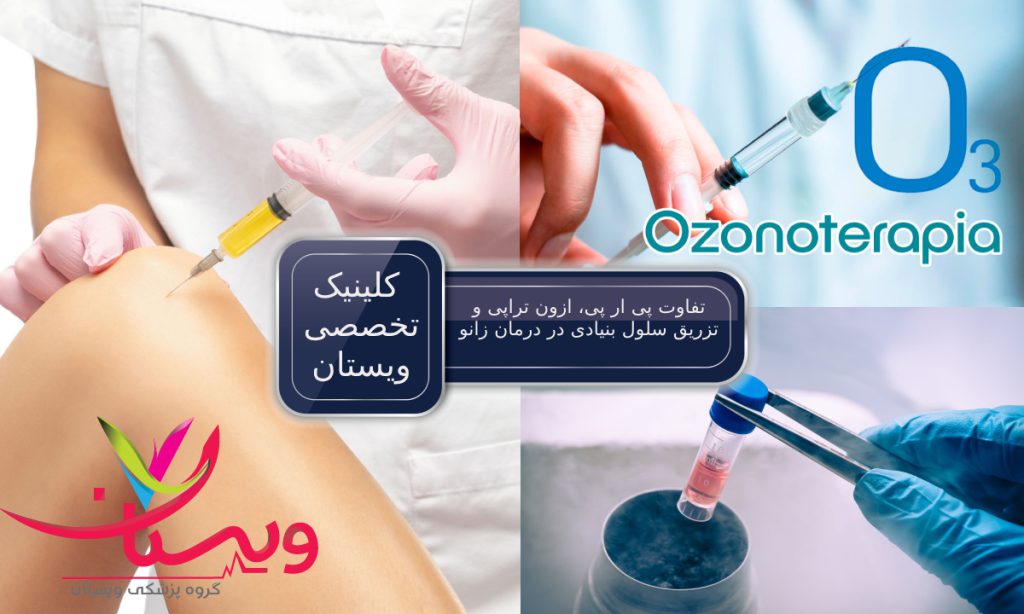 تفاوت پی ار پی، ازون تراپی و تزریق سلول بنیادی در درمان زانو