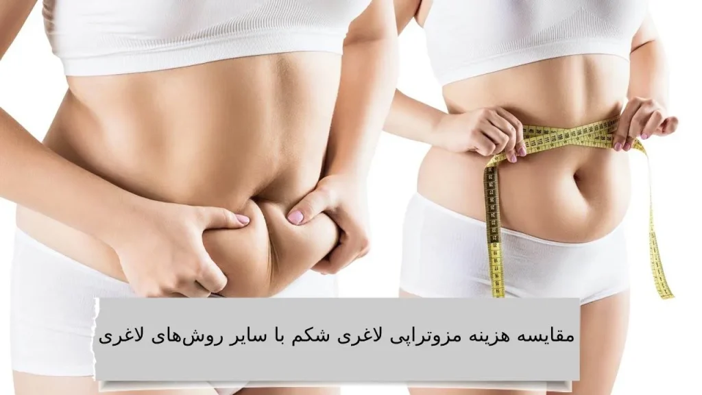 مقایسه هزینه مزوتراپی لاغری شکم با سایر روش های لاغری هزینه مزوتراپی لاغری شکم