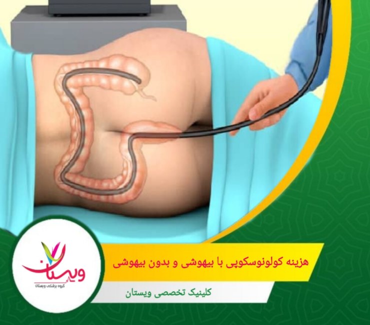 در کولونوسکوپی با بیهوشی عمومی، حضور متخصص بیهوشی الزامی است که این موضوع هزینههای اضافی برای خدمات بیهوشی را به همراه دارد. هزینه کولونوسکوپی با بیهوشی و بدون بیهوشی