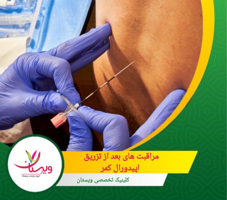 در شب اول پس از تزریق، تنها نباشید و از حضور یک همراه اطمینان حاصل کنید. مراقبت های بعد از تزریق اپیدورال کمر