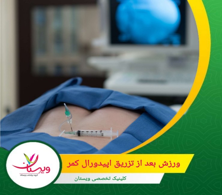 پس از تزریق اپیدورال در ناحیه کمر، انجام ورزشهای مناسب میتواند به تسریع بهبودی و کاهش درد کمک کند. ورزش بعد از تزریق اپیدورال کمر