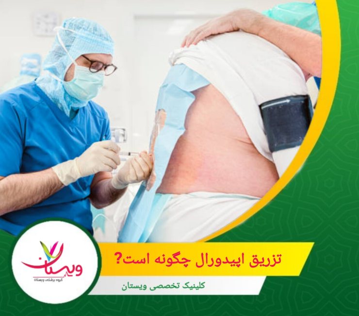 برخی از پزشکان ممکن است ترکیبی از کورتیکواستروئید و بیحسکننده با اثر طولانیمدت را انتخاب کنند. تزریق اپیدورال چگونه است؟