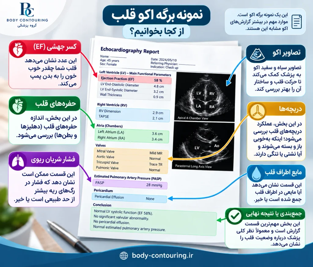 نمونه برگه اکو قلب را از کجا بخوانیم؟